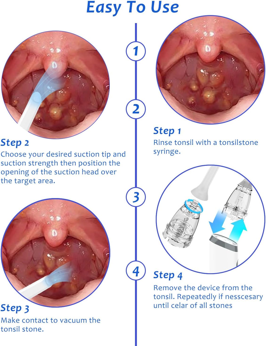 8 Suction Modes 3 Levels Tonsi - Useful Electronic Gadgets 评论和价格
